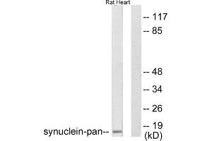 Western blot analysis of extracts from rat heart, using Synuclein-pan antibody (ABIN5976513). (Synuclein antibody  (N-Term, pan))