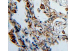 IHC-P analysis of lung tissue, with DAB staining. (HPSE antibody  (AA 419-535))