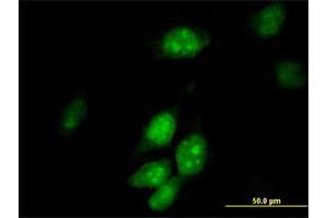 Immunofluorescence of purified MaxPab antibody to TRMT2A on HeLa cell. (TRMT2A antibody  (AA 1-625))