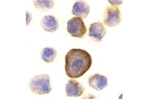 Immunohistochemistry (IHC) image for anti-TP53 Apoptosis Effector (PERP) (C-Term) antibody (ABIN1030575) (PERP antibody  (C-Term))
