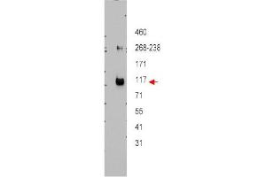 Image no. 1 for anti-ATP-Binding Cassette, Sub-Family B (MDR/TAP), Member 5 (ABCB5) (Internal Region) antibody (ABIN401434)