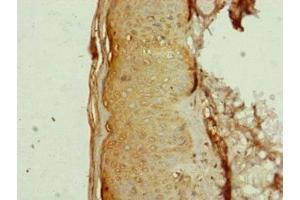 Immunohistochemistry of paraffin-embedded human skin tissue using ABIN7144350 at dilution of 1:100 (AP1M1 antibody  (AA 1-160))