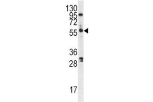Western blot analysis of PLK antibody and A375 cell lysate. (PLK1 antibody  (AA 573-603))