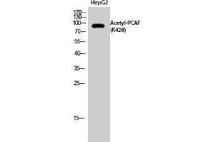 Western Blotting (WB) image for anti-K(lysine) Acetyltransferase 2B (KAT2B) (acLys428) antibody (ABIN3188032) (KAT2B antibody  (acLys428))