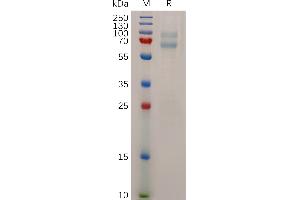 Melanoma Antigen Family A, 4 (MAGEA4) (AA 1-317) protein (His tag)