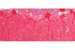 Detection of CALB in Human Cerebellum Tissue using Polyclonal Antibody to Calbindin (CALB) (CALB1 antibody  (AA 3-261))