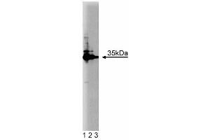 Western blot analysis of HAX-1 on Jurkat cell lysate. (HAX1 antibody  (AA 10-148))