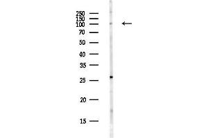 anti-Ubiquitin Specific Peptidase 4 (USP4) antibody