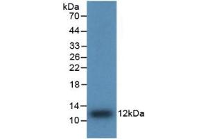 Western Blotting (WB) image for Interleukin 8 (IL8) ELISA Kit (ABIN6574136)