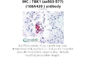 Image no. 1 for anti-TANK-Binding Kinase 1 (TBK1) (AA 563-577) antibody (ABIN5693725) (TBK1 antibody  (AA 563-577))