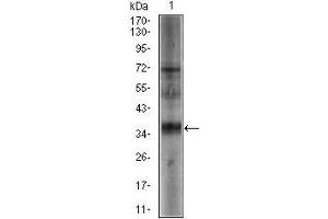 Western blot analysis using SRY mouse mAb against NTERA-2 (1) cell lysate. (SRY antibody  (AA 1-204))