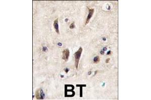 Formalin-fixed and paraffin-embedded human brain tissue reacted with TIE antibody (N-term), which was peroxidase-conjugated to the secondary antibody, followed by DAB staining. (TIE1 antibody  (N-Term))