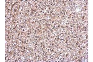 IHC-P Image Immunohistochemical analysis of paraffin-embedded HBL435 xenograft, using TrxR1, antibody at 1:500 dilution. (TXNRD1 antibody)