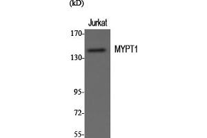 Western Blotting (WB) image for anti-Myosin Phosphatase, Target Subunit 1 (PPP1R12A) (Thr696) antibody (ABIN5957178) (PPP1R12A antibody  (Thr696))