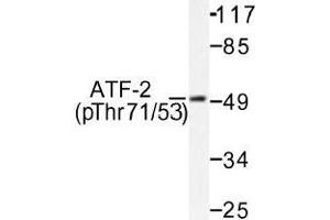 Image no. 1 for anti-Activating Transcription Factor 2 (ATF2) (pThr53), (pThr71) antibody (ABIN317966) (ATF2 antibody  (pThr53, pThr71))