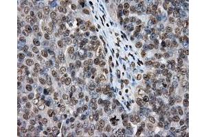 Immunohistochemical staining of paraffin-embedded colon tissue using anti-DAPK2 mouse monoclonal antibody.
