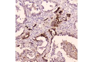 IHC analysis of Cathepsin E using anti-Cathepsin E antibody (ABIN5692831).