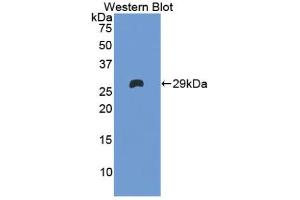 Western blot analysis of the recombinant protein. (Factor XI antibody  (AA 170-398))