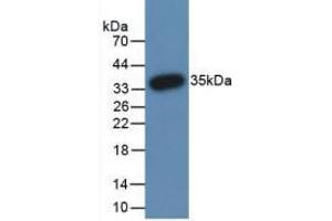 Western Blot; Sample: Recombinant PADI3, Human. (PADI3 antibody  (AA 1-300))