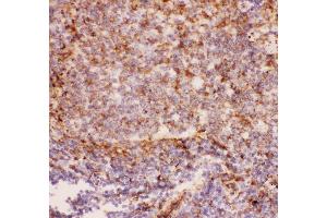 Anti-CD11b Picoband antibody ,  IHC(P): Rat Spleen Tissue (CD11b antibody  (AA 17-382))