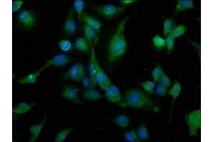Immunofluorescence staining of U251 cells with ABIN7146257 at 1:200, counter-stained with DAPI. (CALB1 antibody  (AA 2-261))