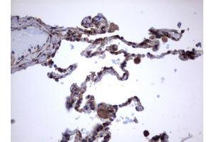 Image no. 2 for anti-Tumor Necrosis Factor Receptor Superfamily, Member 8 (TNFRSF8) (AA 19-379) antibody (ABIN1491086) (TNFRSF8 antibody  (AA 19-379))