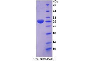 Image no. 1 for RAB37, Member RAS Oncogene Family (RAB37) (AA 19-220) protein (His tag) (ABIN6236483) (RAB37 Protein (AA 19-220) (His tag))