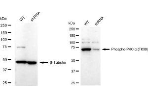 Western blotting analysis using Phospho-PKC alpha (T638) antibody (ABIN7799987).