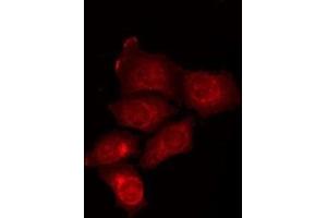 ABIN6275881 staining HepG2 by IF/ICC. (ATG16L2 antibody  (Internal Region))