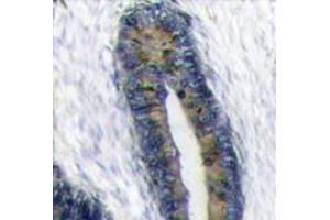 Image no. 2 for anti-Finkel-Biskis-Reilly Murine Sarcoma Virus (FBR-MuSV) Ubiquitously Expressed (FAU) (Center) antibody (ABIN357137) (FAU antibody  (Center))