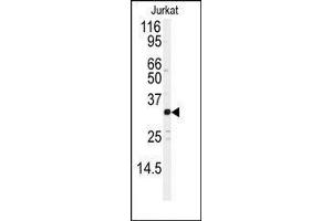 Western blot analysis of anti-JUND Antibody in Jurkat cell line lysates (35ug/lane). (JunD antibody  (Ser2655))