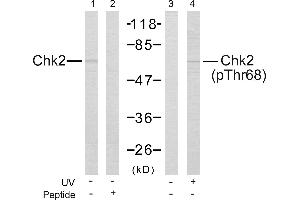 Western blot analysis of the extracts from Jurkat cells untreated or treated with UV using Chk2 (Ab-68) Antibody and Chk2 (Phospho-Thr68) Antibody. (CHEK2 antibody  (pThr68))