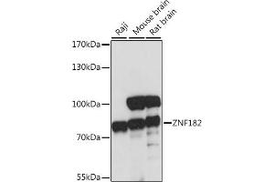 Western blot analysis of extracts of various cell lines, using ZNF182 antibody (ABIN7271462) at 1:1000 dilution. (ZNF182 antibody  (AA 100-210))