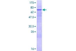 ABHD12 Protein (AA 1-404) (GST tag)