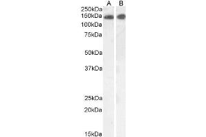 Western Blotting (WB) image for anti-Leptin Receptor (LEPR) (Internal Region) antibody (ABIN185639)