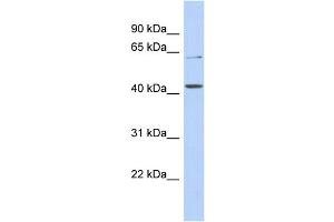 WB Suggested Anti-SLC22A12 Antibody Titration:  0. (SLC22A12 antibody  (N-Term))