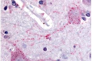 Human Brain, Cortex (formalin-fixed, paraffin-embedded) stained with PCSK6 antibody ABIN213558 at 20 ug/ml followed by biotinylated goat anti-rabbit IgG secondary antibody ABIN481713, alkaline phosphatase-streptavidin and chromogen. (PCSK6 antibody  (Internal Region))