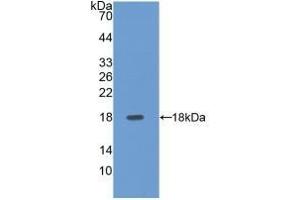 Detection of Recombinant SELE, Human using Polyclonal Antibody to E-selectin (Selectin E/CD62e antibody  (AA 108-238))