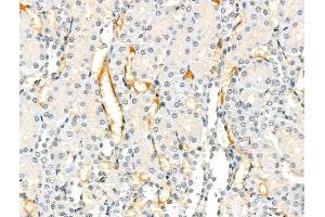 anti-Interferon alpha/beta Receptor 1 (IFNAR1) (pTyr466) antibody
