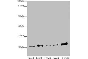 Western blot All lanes: COMMD1 antibody at 5. (COMMD1 antibody  (AA 1-190))