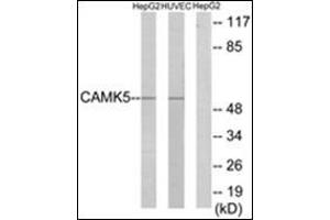Western blot analysis of extracts from HepG2/HuvEc cells, using CAMK5 Antibody. (CAMKV antibody)