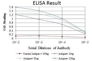 Red: Control Antigen (100 ng), Purple: Antigen (10 ng), Green: Antigen (50 ng), Blue: Antigen (100 ng), (CEBPB antibody)