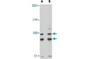 Western blot analysis of SATB1 in A-20 cell lysate with SATB1 polyclonal antibody  at (A) 2 and (B) 4 ug/mL . (SATB1 antibody  (C-Term))