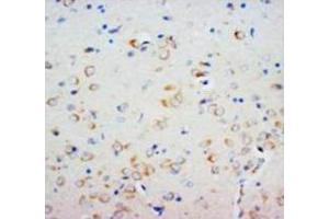 Immunohistochemical analysis of paraffin embedded rat tissue sections (brain), staining SHH in cytoplasm, DAB chromogenic reaction (Sonic Hedgehog antibody  (N-Term))