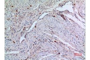 Immunohistochemistry (IHC) image for anti-Replication Factor C (Activator 1) 1, 145kDa (RFC1) (C-Term) antibody (ABIN3187893)