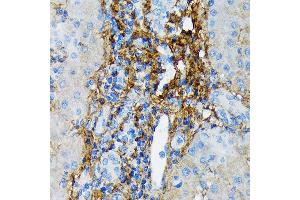 Immunohistochemistry of paraffin-embedded human liver using Collagen VI/COL6 Rabbit mAb (ABIN7266462) at dilution of 1:100 (40x lens). (COL6A1 antibody)