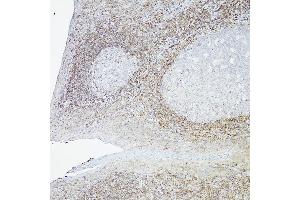 Immunohistochemistry of paraffin-embedded Human tonsil(100X) using Bcl-2 antibody (ABIN7265810) at dilution of 1:100 (40x lens). (Bcl-2 antibody)