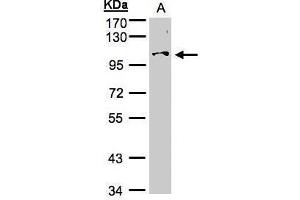 WB Image Sample (30μg whole cell lysate) A:Hep G2 , 7. (NCKAP1 antibody)