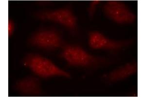 Image no. 1 for anti-Cyclin-Dependent Kinase 6 (CDK6) (pTyr24) antibody (ABIN319290) (CDK6 antibody  (pTyr24))