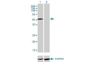 Western blot analysis of IL13RA2 over-expressed 293 cell line, cotransfected with IL13RA2 Validated Chimera RNAi (Lane 2) or non-transfected control (Lane 1).